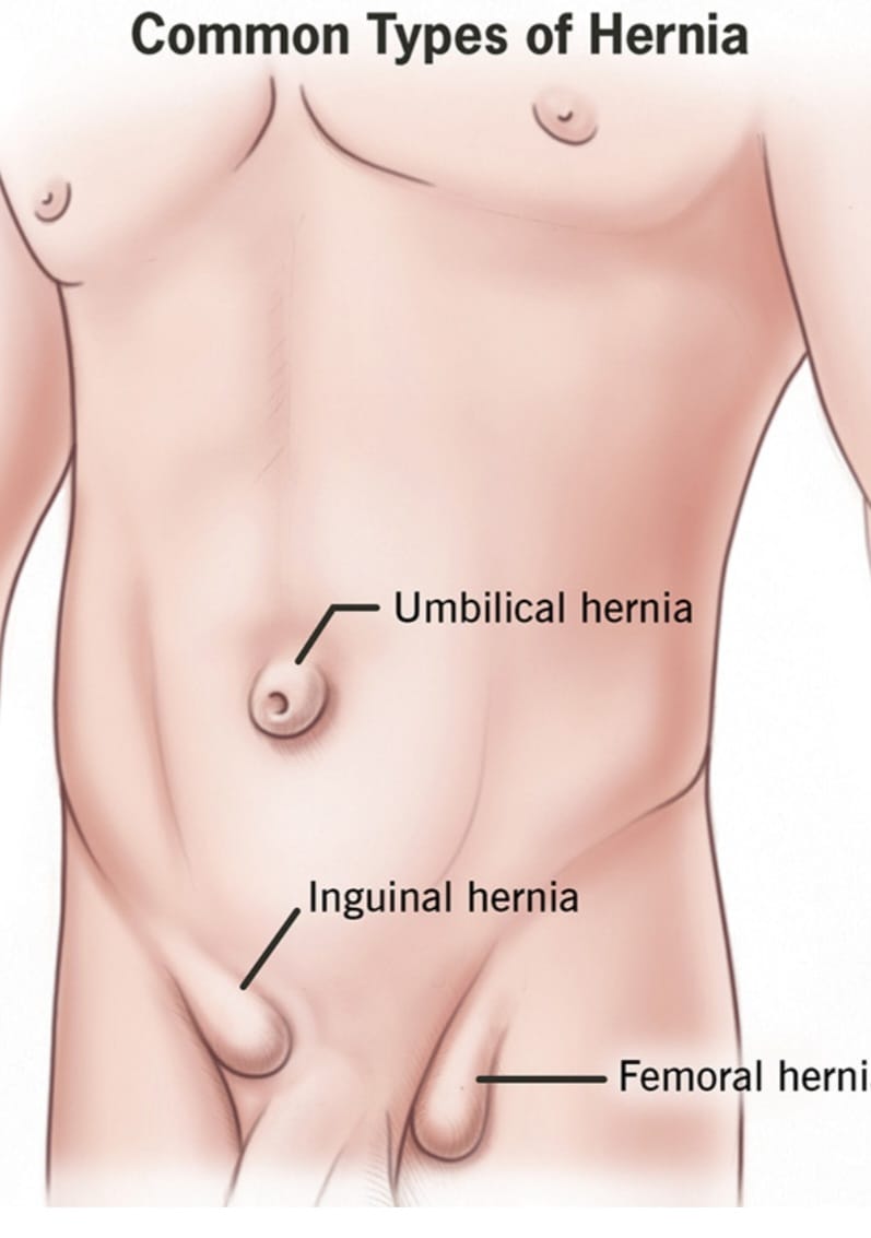 Emergency Medical Team